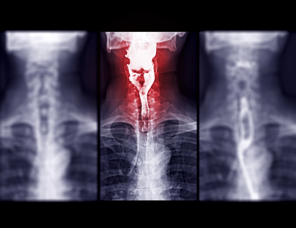 GI Studies (Barium)